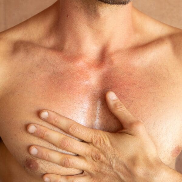 natural-remedies-for-thrombosis